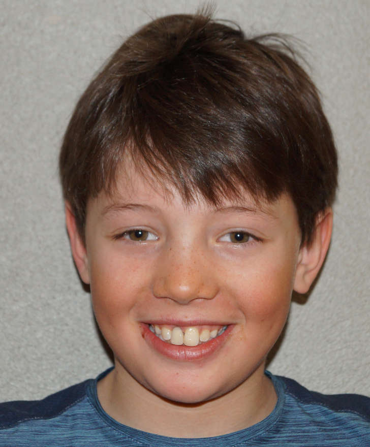 Mountain Athletes | ARON SALZMANN