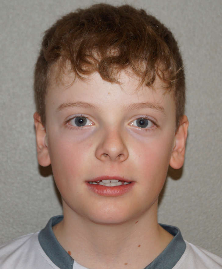 Mountain Athletes | JARNO KUMMER