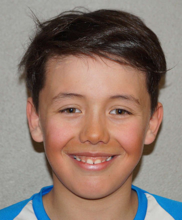 Mountain Athletes | LAURIN SALZMANN